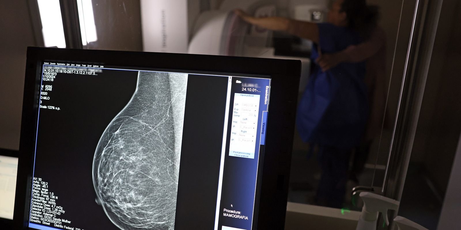 Câncer de mama: diagnóstico precoce amplia chance de cura
